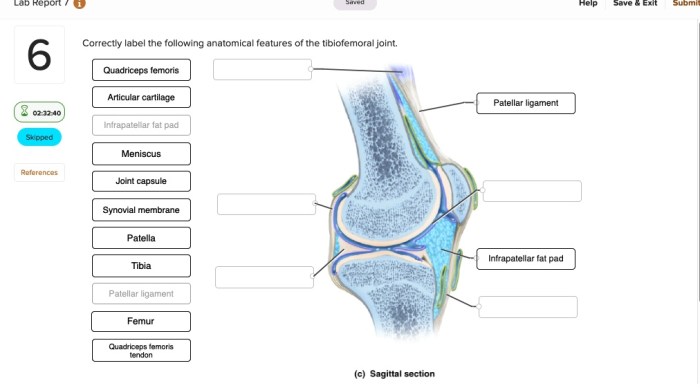 Anatomical correctly label features following semicircular canals cupula solved