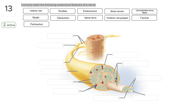 Correctly label the anatomical features of the otolithic membrane.